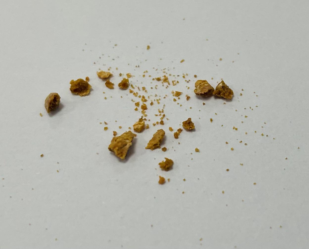 1760341099210421.png 尿酸结石.png